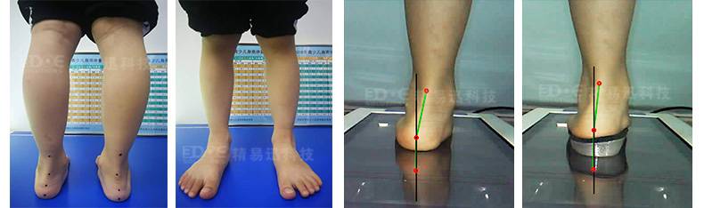 1634176677188936.jpg 足底三维扫描仪-矫形鞋垫_06.jpg